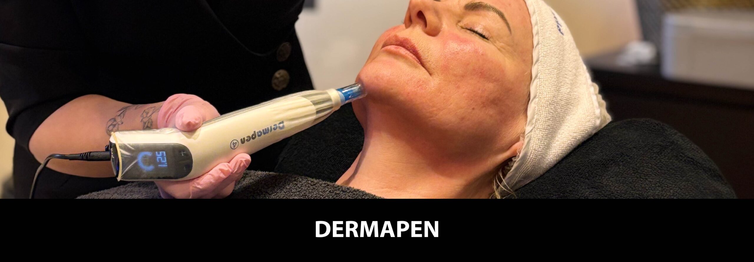 dermapen Emmen